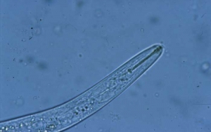 Le stylet de ce nématode adulte est particulièrement bien visible. <i>Pratylenchus</i> sp. (lesion nematodes) 