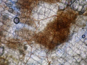 Au microscope, on constate que ces ébauches de sclérote sont constituées par l'enchevêtrement du mycélium mélanisé de <b><i>Rhizoctonia solani</i></b>. 