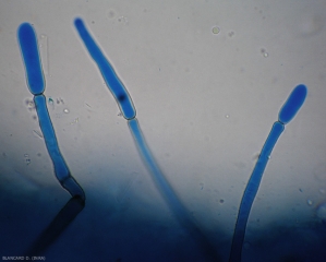 Des jeunes conidies  sont en cours de formation à l'extrémité de conidiophores dressés de Corynespora cassiicola.
(corynesporiose)