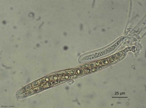 leptosphaeria_colza6