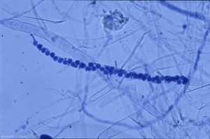 pisum-sativum_aphanomyces