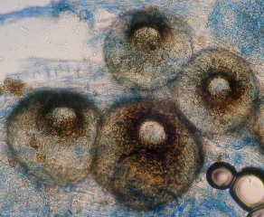 Fructifications de  <i><b>Didymella bryoniae</b></i>  observées au microscope photonique.(chancres gommeux sur tige, gummy stem blight)