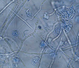 Jeunes conidiophores de <b><i>Fusarium oxysporum</i> f. sp. <i>lycopersici</i> </b> formant des microconidies unicellulaires. <b>Fusariose vasculaire (<i>Fusarium</i> wilt)</b>