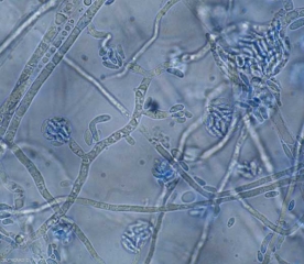 Jeunes conidiophores de <b><i>Fusarium oxysporum</i> f. sp. <i>lycopersici</i> </b> formant des microconidies unicellulaires. <b>Fusariose vasculaire (<i>Fusarium</i> wilt)</b>