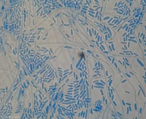 Aspect du mycélium et des conidies de <b><i>Verticillium dahliae</i></b> (verticilliose, <i>Verticillium</i> wilt).