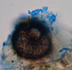 Aspect d'une pycnide mature : des conidies sont extrudées par l'ostiole.  <b><i>Phoma cucurbitacearum</i></b> (forme anamorphe)(pourriture noire, black rot)