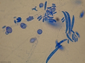 Aspect de microconidies, de macroconidies et de chlamydospores de  <b><i>Fusarium oxysporum</i></b>