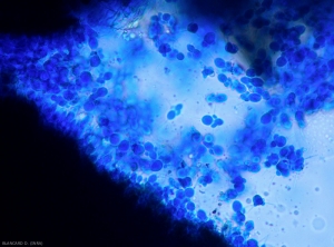 Le champignon responsable de l'Entomosporiose produit de nombreuses spores au centre des taches sur feuilles, comme on peut le constater grâce à un microscope.