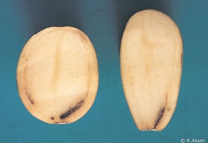 Brunissement de l'anneau vasculaire plus prononcé au niveau du talon de tubercules de pomme de terre atteints par <i><b>Verticillium</i> sp.</b> (verticilliose)