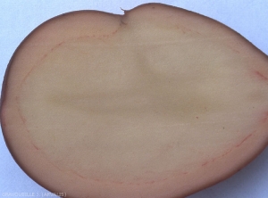 Coloration de l'anneau vasculaire d'un tubercule de pomme de terre provoquée par de fortes chaleurs