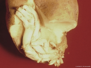 Phénomène de germination interne : développement de germes dans le tubercule de pomme de terre