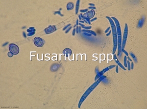 Diagno-Fusarium