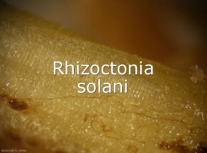 Rhizoctonia-Mycelium-cloisonne