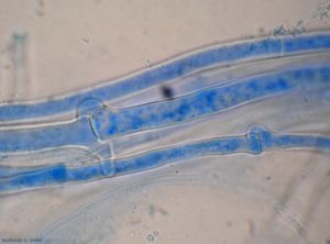 Sclerotium-rolfsii7