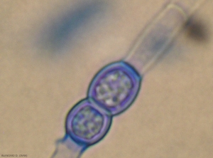 Détail d'une chlamydospores de <i>Fusarium</i> sp. 