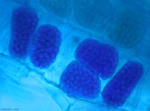 Spongospora5