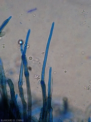 Détail d'une jeune conidie se formant à l'extrémité d'un conidiophore mélanisé. Notez la présence de quelques cloisons transversales à la base de la spore. <i>Cercospora</i> sp. (cercosporiose)