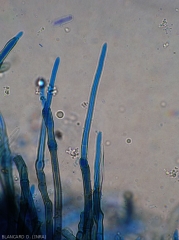 Détail d'une jeune conidie se formant à l'extrémité d'un conidiophore mélanisé. Notez la présence de quelques cloisons transversales à la base de la spore. <i>Cercospora</i> sp. (cercosporiose)