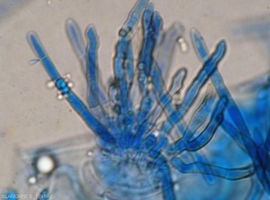 Détail de conidiophores émergeant d'un stomate présent sur cette portion de feuille observée au microscope photonique. Quelques jeunes conidies cloisonnées sont en cours de formation. <i>Pseudocercospora fuligena</i> (cercosporiose)