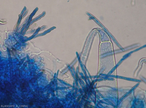 Plusieurs conidiophores émergeant d'un stomate et des conidies sont présents sur cette portion de feuille observée au microscope photonique.
<i>Pseudocercospora fuligena</i> (cercosporiose)