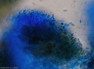 Concentration de conidiophores à l'extrémité desquels commencent à se former des conidies (acervule mature). <i><b>Elsinoë ampelina</b></i> (Anthracnose)