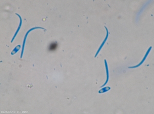 Détail de spores alpha et beta de <b><i>Phomopsis vexans</i></b>.