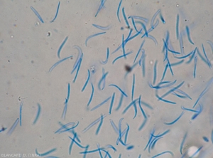 Aspect au microscope photonique d'un cirrhe de spores beta de <b><i>Phomopsis vexans</i></b>.