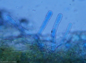 Aspect de plusieurs conidiophores produits par <b><i>Oidium neolycopersici</i></b> et observés au microscophe photonique. <b>Oïdium externe (powdery mildew, white mold)</b>