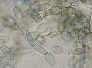 De nombreuses conidies irrégulières, parfois cloisonnées et brunâtres, sont observées sur le limbe. <b><i>Passalora fulva</i></b> (cladosporiose, leaf mold)