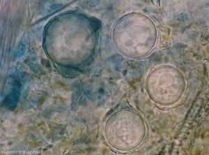 Plusieurs oospores de <i>Plasmopara viticola</i> se sont récemment formées sur cette feuille de vigne <b>Mildiou de la vigne</b>.