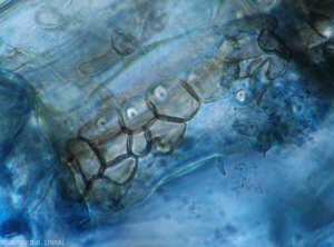 Ebauche d'un microsclérote de <b><i>Colletotrichum coccodes</i></b>se formant dans une cellule du cortex.