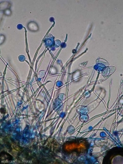 Plusieurs jeunes sporangiophores pourvus de renflements sont en train de se développer. (<i>Phytophthora infestans</i>) (mildiou)