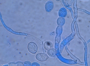 Trois conidies forment un début de chaîne à l'extrémité d'un court conidiophore de <i><b>Podosphaera xanthii</b></i>. (oïdium)