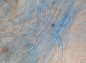 A l'aide d'un microscope photonique, on peut observer le mycélium caractéristique de <i><b>Rhizoctonia solani</b></i>.