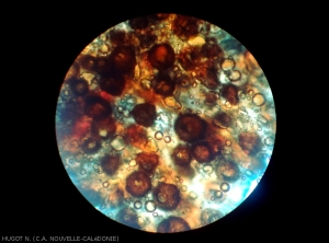 Observation au microscope de pycnides d'un <i><b>Phoma</i> sp.</b> présentes sur une zone nécrosée d'une feuille de taro atteinte de criblure.