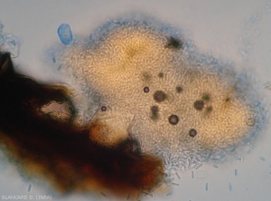 Aspect d'une acervule en coupe sur laquelle on distingue les nombreuses conidies formées restant agglomérées en masse. <i><b>Colletotrichum</i> sp</b>. (ripe rot)