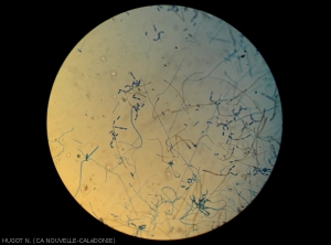 Vision d'ensemble des sporulations de <i><b>Cladosporium colocasiae</b></i> sur une feuille de taro d'eau.