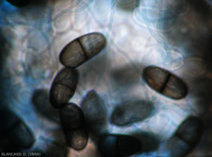 Les conidies de <i>Lasiodiplodia theobromae</i> sont d'abord hyalines et non cloisonnées, et deviennent brun sombre, disposant d'une cloison et de striations irrégulières longitudinales. (anamorphe de <i>Botryosphaeria rhodina</i>)