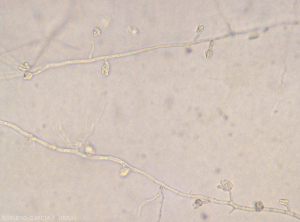 Aspect de microconidies de <b><i> Fusarium oxysporum </i> f.  sp.  <i> melongenae </i></b> regroupées en fausse tête à l'extrémité de conidiophores monophialides courts. 