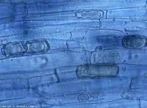 Des chlamydospores  (ou kystes ou spores de repos) d'<b><i>Olpidium brassicae</i></b>, en forme d'étoiles du fait de replis de la paroi intérieure, sont visibles dans plusieurs cellules du cortex.