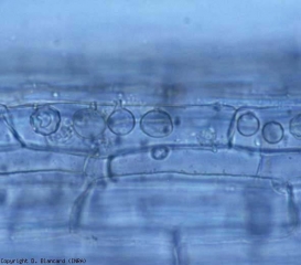 Les zoospores ont été libérées, on distingue bien des tubes de décharge. <i><b>Olpidium brassicae</b></i>