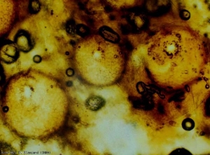 Des pycnides brunes, globuleuses et ostiolées sont visibles dans les tissus. <b><i>Didymella lycopersici</i></b> (chancre à <i>Didymella</i>, <i>Didymella</i> foot rot)