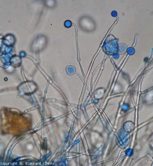 Plusieurs jeunes sporangiophores pourvus de renflements sont en train de se développer. <b><i>Phytophthora infestans</i></b> (mildiou)