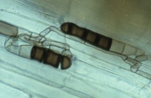 Dans les cellules du cortex de la racine, on distingue des chlamydospores en forme de tonnelets empilés (25-60 x 10-12 µm) se mélanisant progressivement. <b><i>Thielaviopsis basicola</i></b> (<i>Chalara elegans</i>, "black root rot")