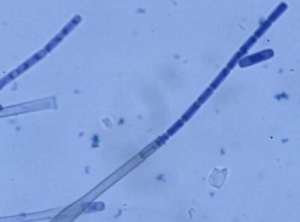 Une phialide très allongée produit des endoconidies (10-23 x 3-5 µm) cylindriques et hyalines. <b><i>Thielaviopsis basicola</i></b> (<i>Chalara elegans</i>, "black root rot")