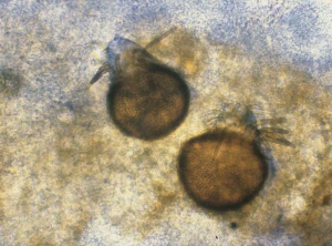 Les pycnides de <b><i>Pyrenochaeta lycopersici</i></b> ("fungal corky root") sont pourvues de soies brunes (setae) de taille irrégulière. Elles produisent des conidies ellipsoïdes (4-6 x 1-1,5 µm).