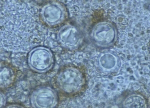 Dans les tissus altérés, on observe parfois des oospores brunes de 27 à 30 µm de diamètre. Elles assurent la reproduction sexuée de ce champignon hétérothallique. <i><b>Bremia lactucae</b></i> (mildiou de la salade, "downy mildew")
