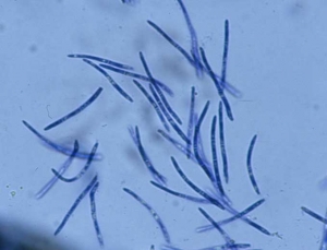 Les conidies produites par les pycnides de <b><i>Septoria lactucae</i></b> (septoriose, "<i>Septoria</i> leaf spot") sont hyalines et filiformes ; elles montrent de 1 à 3 cloisons. Leurs dimensions sont variables : 25-40 x 1,5-2 µm.

