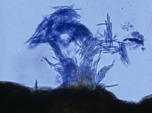 Pycnide de <b><i>Septoria lactucae</i></b> (septoriose, "<i>Septoria</i> leaf spot") en partie immergée dans les tissus foliaires (100 à 200 µm de diamètre) : un bouquet de spores est libéré au niveau de l'ostiole.