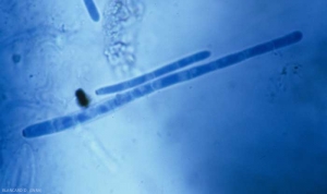 Les conidies formées à l'extrémité des conidiophores sont hyalines et cylindriques. Elles montrent de 1 à 18 cloisons et mesurent de 11 à 170 µm de long. <b><i>Cercospora longissima</i></b> (cercosporiose, <i>cercospora</i> leaf spot)